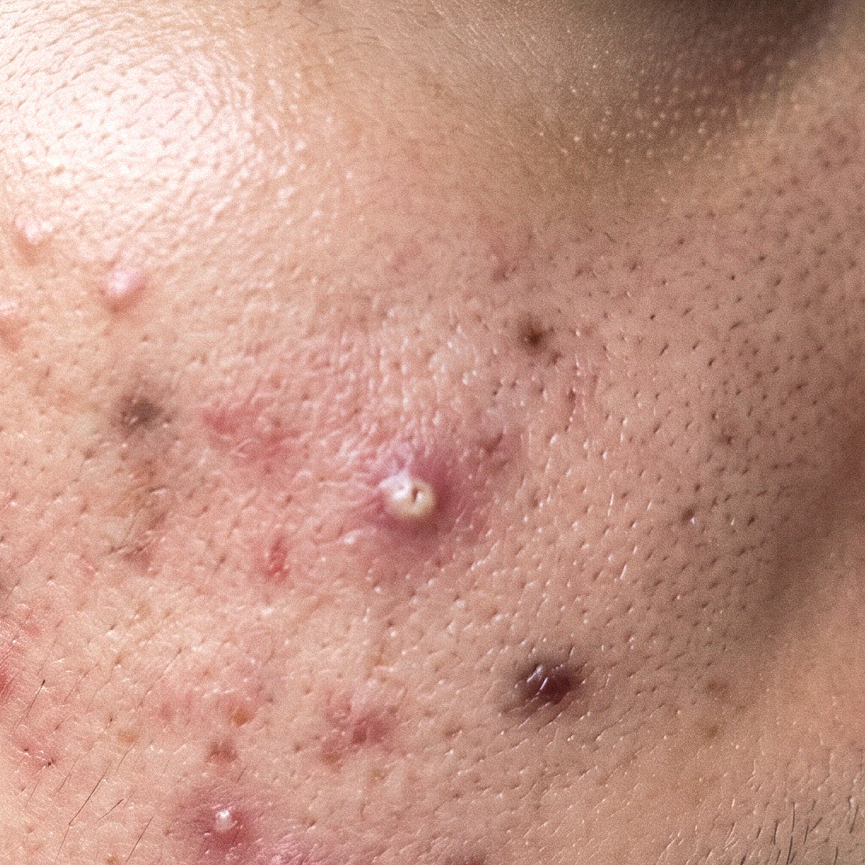 Close-up of skin showing dark marks and uneven tone