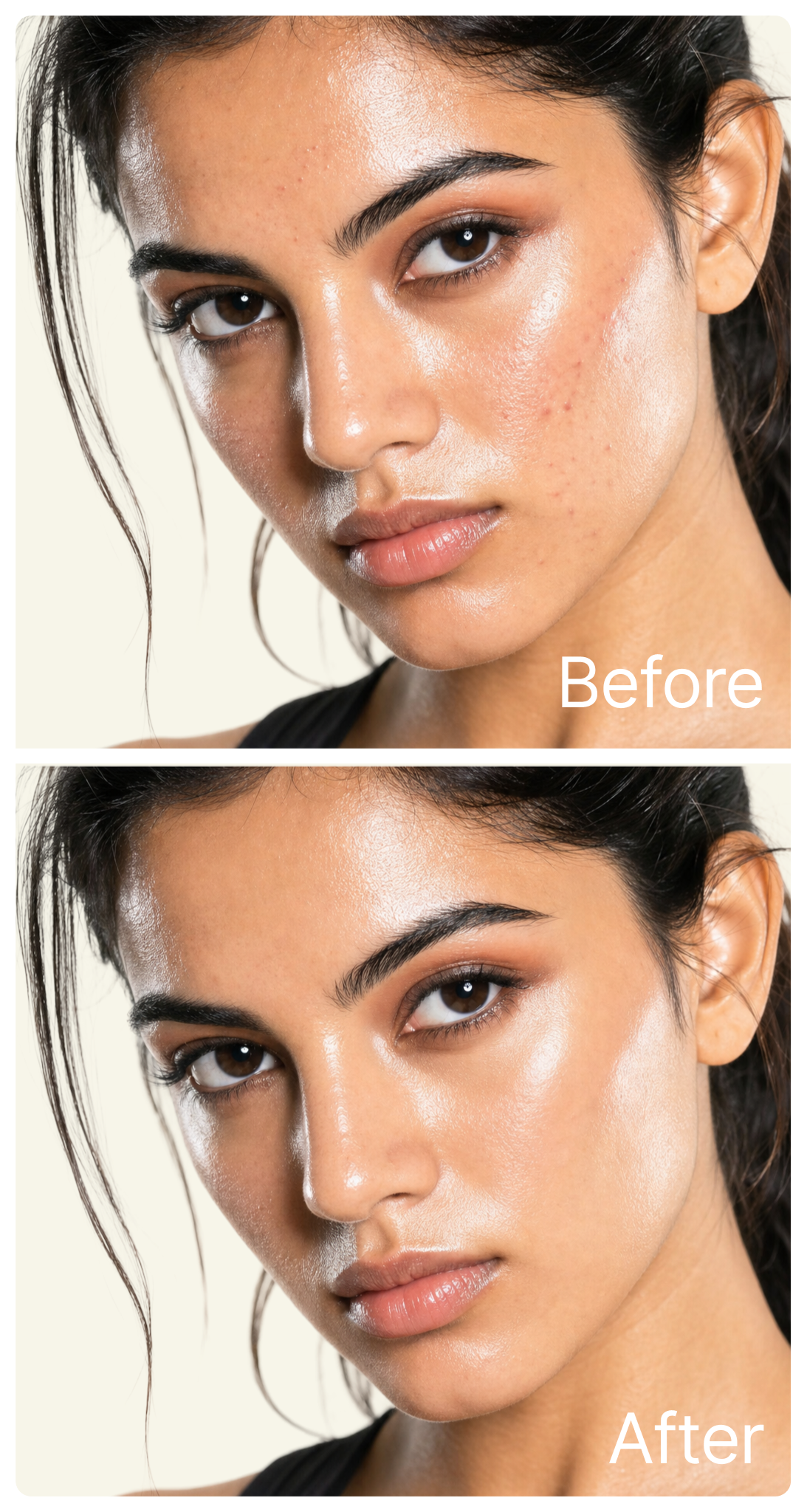 Six week before and after skin results